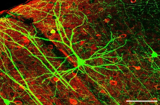 Greek headed research diving into the mystery of multiple sclerosis