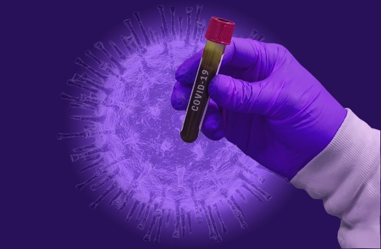 No monkeypox virus in lab examination of suspected case sample in Greece