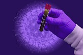 Η Κομισιόν ενέκρινε νέα σύμβαση με τη Novavax για πιθανό εμβόλιο κατά της νόσου COVID-19
